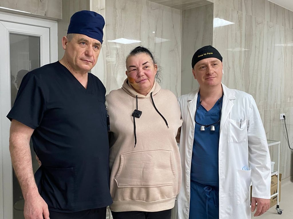 Обломки вражеской ракеты лишили лица - история женщины из Рубежного, которая учится улыбаться - фото 4