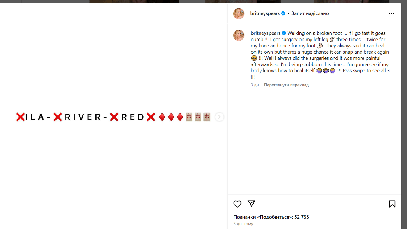 Бритни Спирс сообщила о сломанной ноге. Фото: instagram.com/britneyspears