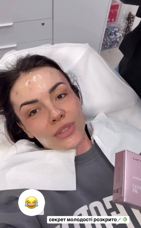 MamaRika показала обличчя після уколів краси