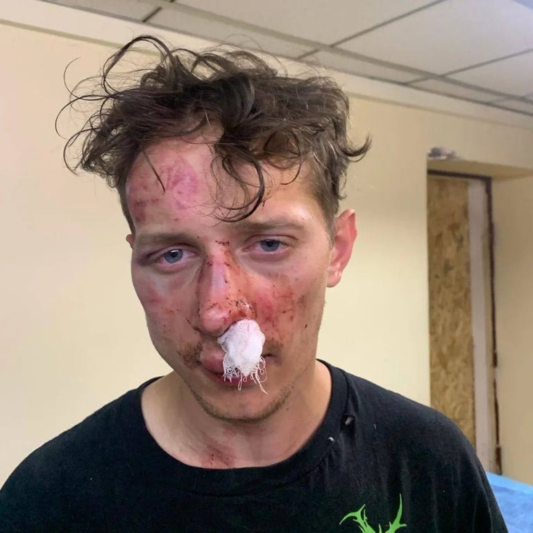 У Києві побили ветерана війни