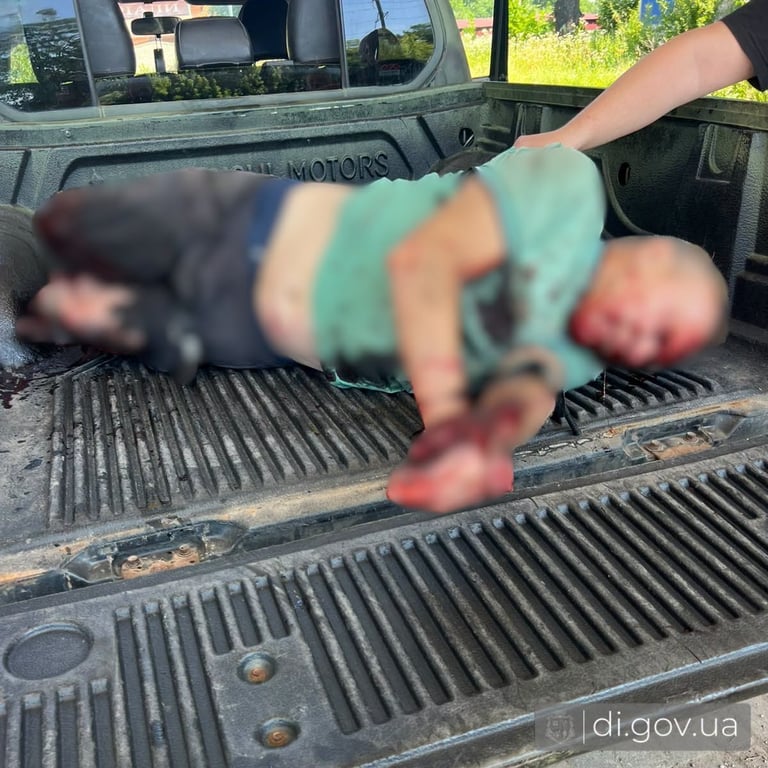 Чоловік, який дістав поранення