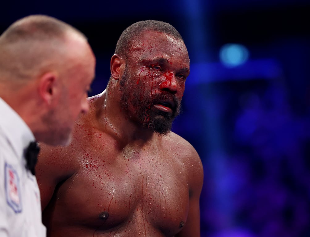 Дерек Чісора під час бою