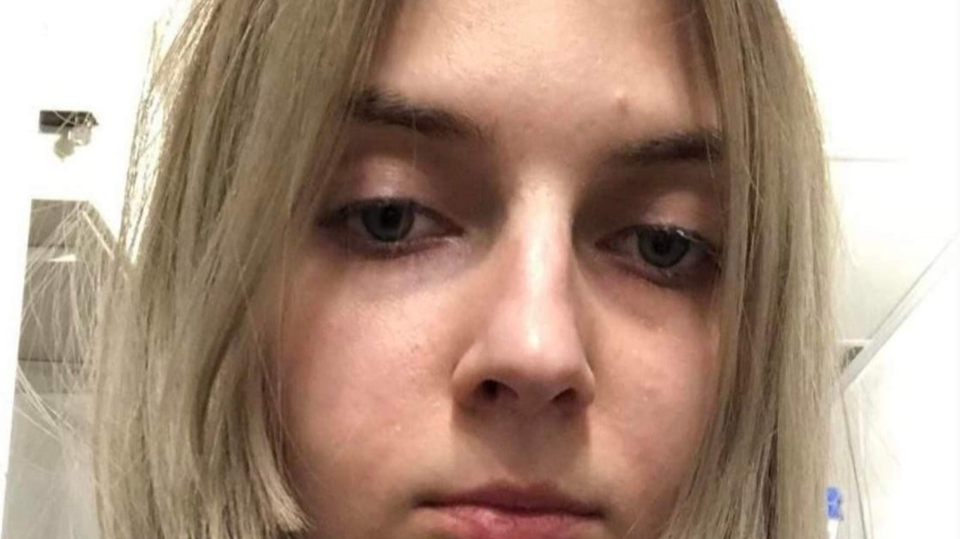 В Одесі зникла 23-річна Олександра Каськова з психічним розладом