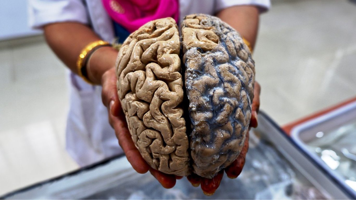 Людський мозок невпинно росте — як це вплине на інтелект майбутніх поколінь