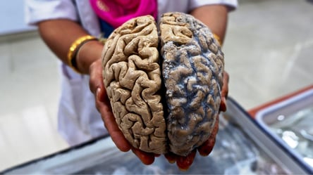 Мозок людей стає більшим з кожним десятиліттям — як це вплине на інтелект - 285x160