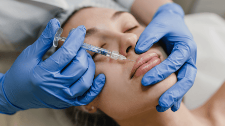 Дівчина зробила губи за 2 мільйони гривень — чому її захейтили - 285x160