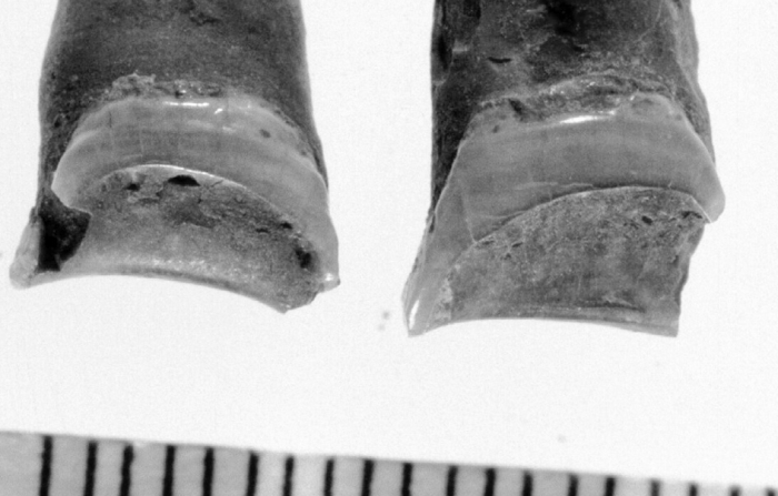 Запретная профессия — что удалось узнать ученым за зубами древней египтянки