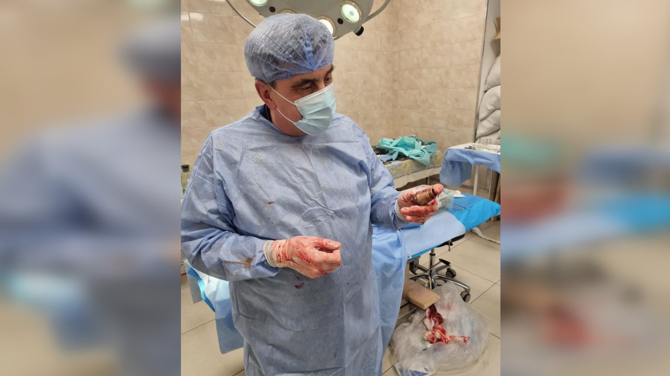 Лікарі провели операцію з видалення гранати з тіла військовослужбовця: фото