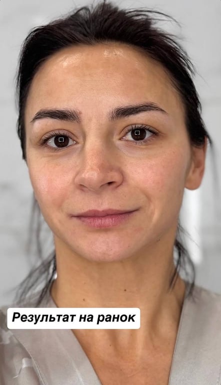 Ілона Гвохдьова показала обличчя без макіяжу