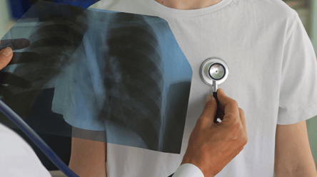 Лікування туберкульозу — яким буде рішення ТЦК - 285x160