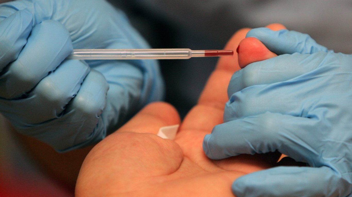 Новий тест для виявлення ВІЛ та гепатиту вимагає лише однієї краплі крові
