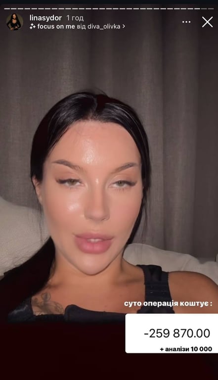 Аліни Сидор розсекретила вартість операції. Фото: instagram/linasydor