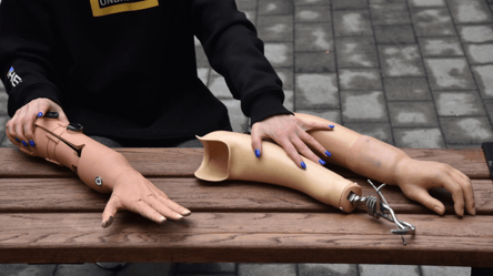 Якість протезів в Україні — які проблеми наразі існують - 285x160