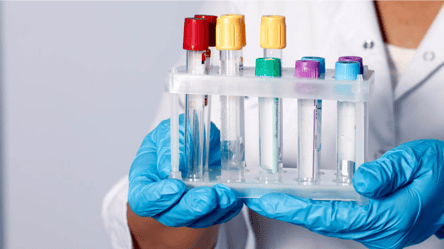 Пробы Манту в Украине больше не будет: появится новый тест - 290x160