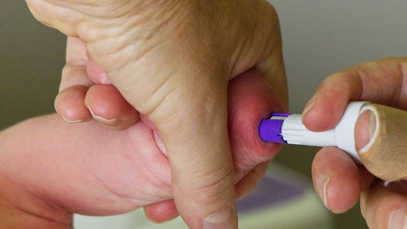 Полиомиелит в Украине - Минздрав призвал срочно вакцинировать детей