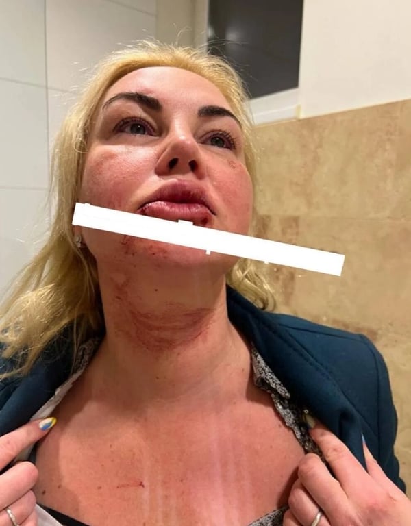 Камалия побои