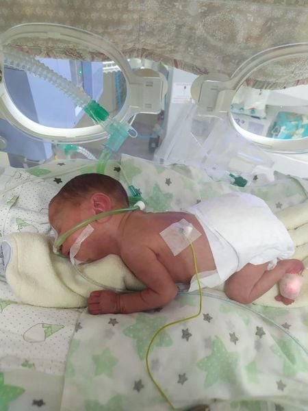 У Львові врятували хлопчика, який народився з вагою менше кілограма - фото 2