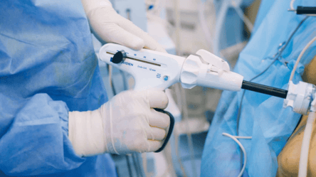 Видалений жовчний міхур — чи можуть таку особу мобілізувати - 290x166