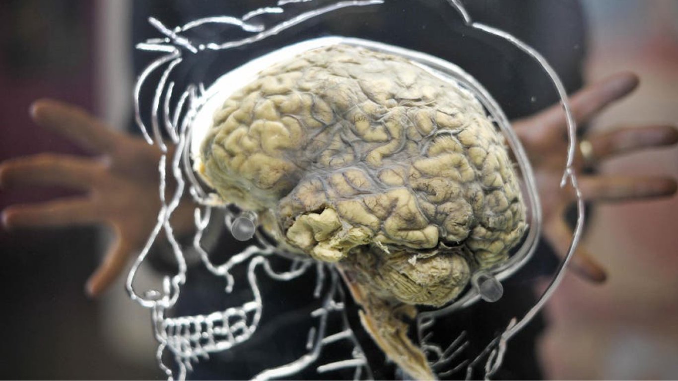 Вчені навчилися оживляти мозок — як це змінює традиційні погляди на смерть