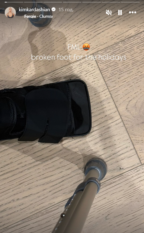 Кім Кардаш'ян зламала ногу