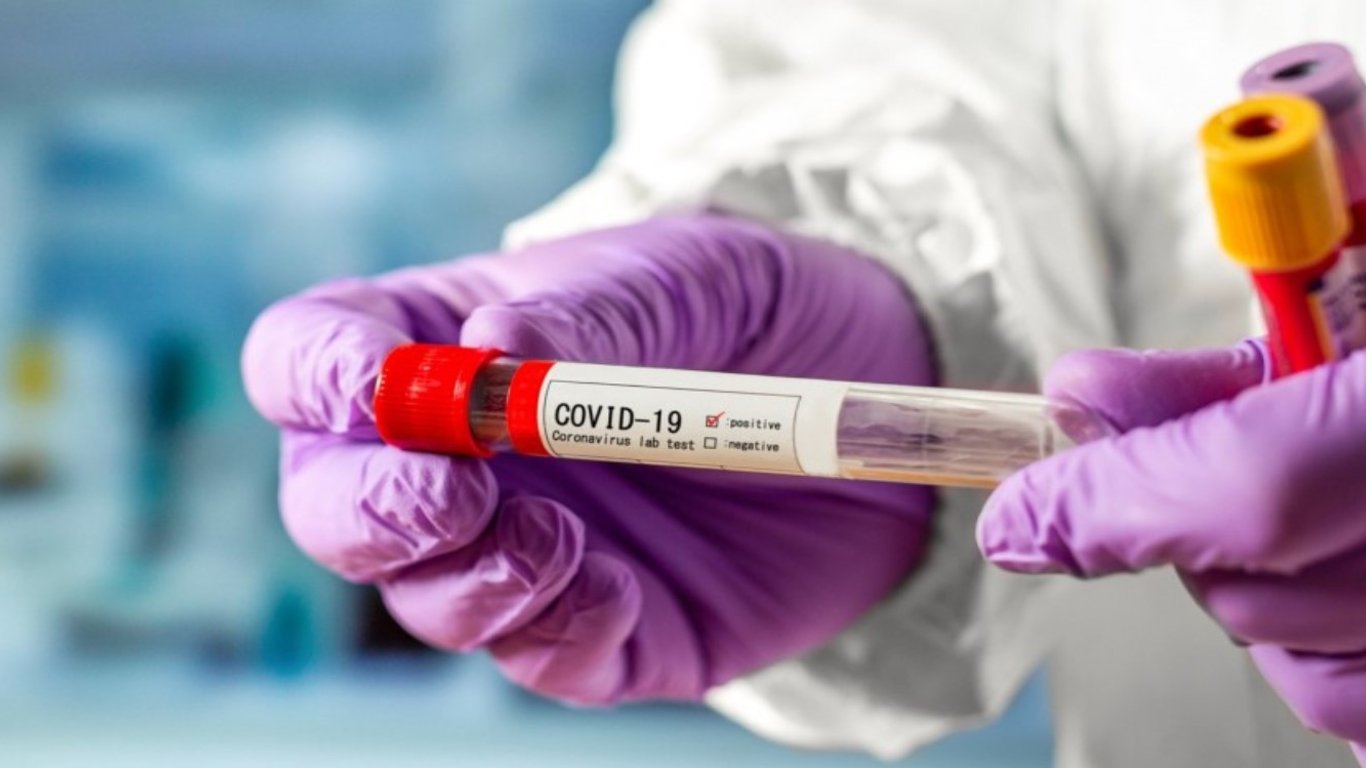 COVID-статистика в Украине: сколько людей заболело коронавирус 31 июля