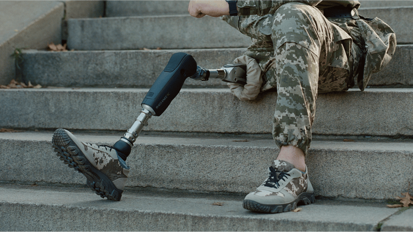 Сотні папірців і обмежені виплати: як військовому без кінцівки отримати протез в Україні - 250x140