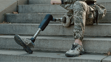 Сотні папірців і обмежені виплати: як військовому без кінцівки отримати протез в Україні - 285x160