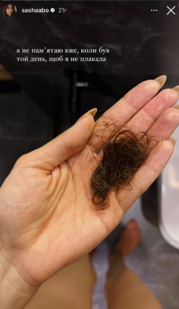 У Саши Бо сильно выпадают волосы