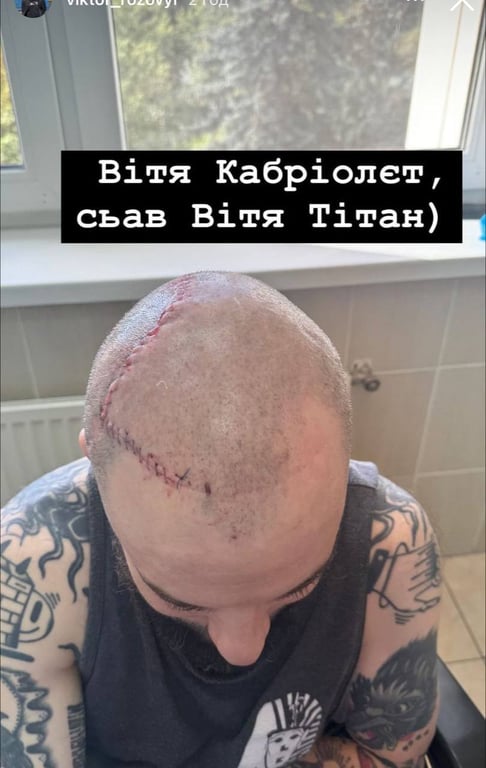 Виктор Розовый после операции. Фото: instagram/viktor_rozovyi