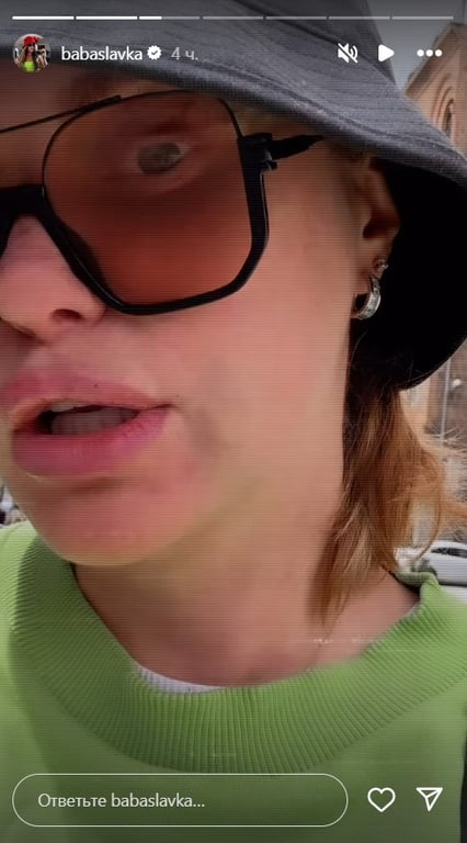 Каминская сделала пластику