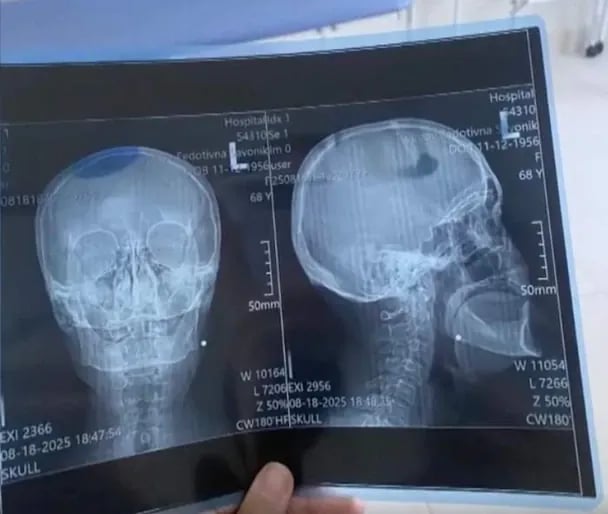 На Волині працівник ТЦК вистерлив у жінку