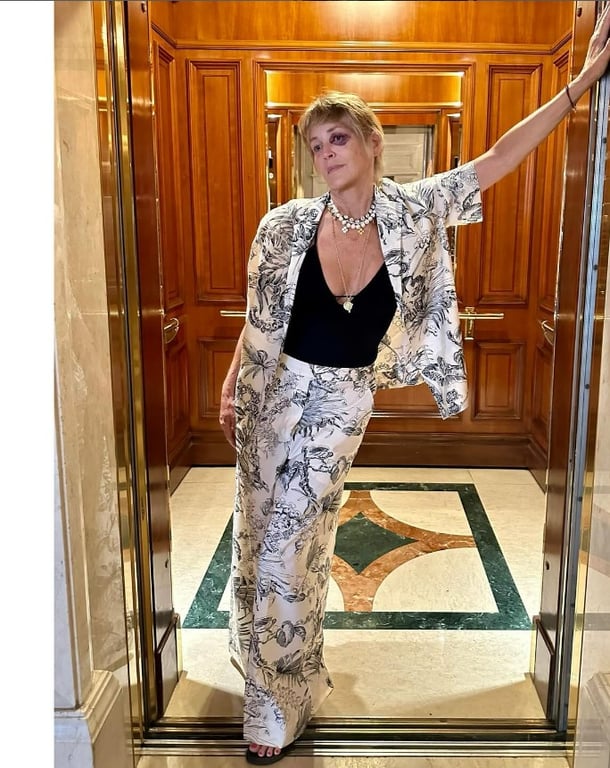 Шерон Стоун шокувала підбитим оком — фото - фото 1