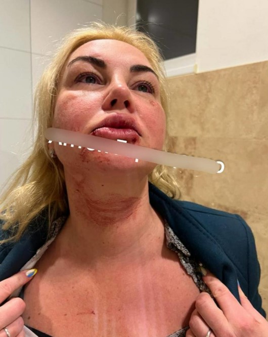 Камалію побили