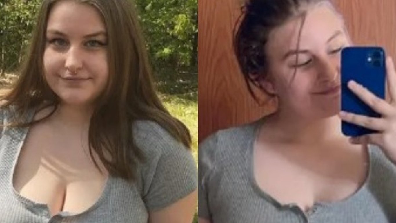 Девушка уменьшила грудь на три размера: как она теперь выглядит - фото до и после