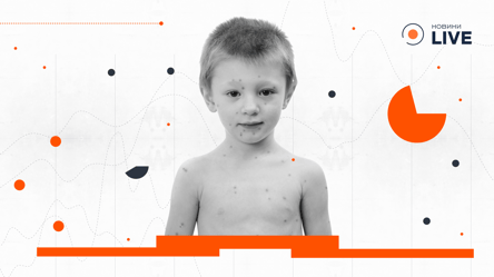 Вітрянка і батьківські міфи — як вони шкодять дітям - 290x166