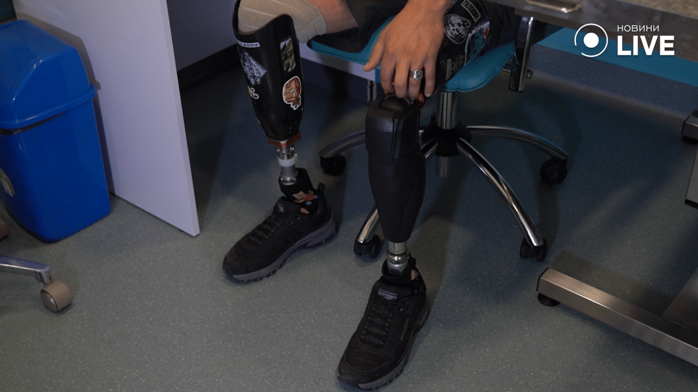 Протези ветеринара. Фото: Новини.LIVE 