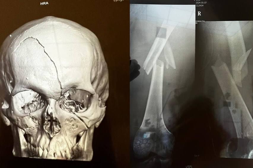 ДТП у прифронтовій зоні