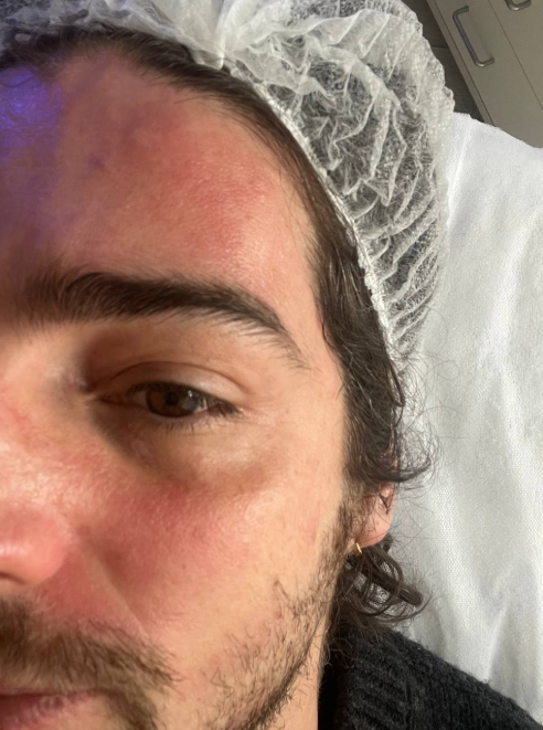 Володимир Дантес показався у косметолога