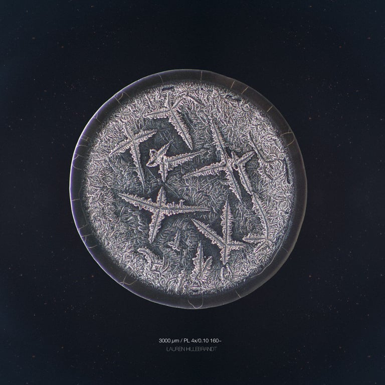 Как выглядят человеческие слезы под микроскопом — уникальны, как снежинки.