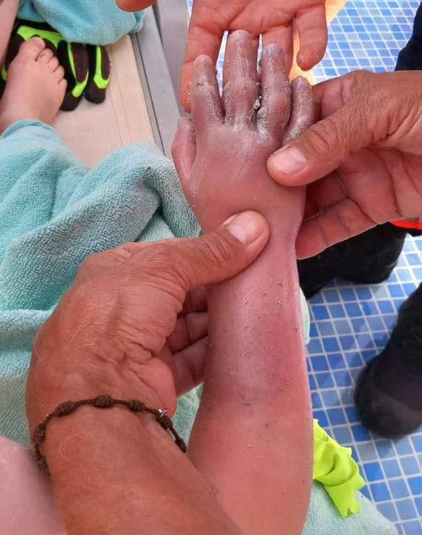 Жах на Майорці — дитину засмоктало у вентиляцію басейна - фото 1