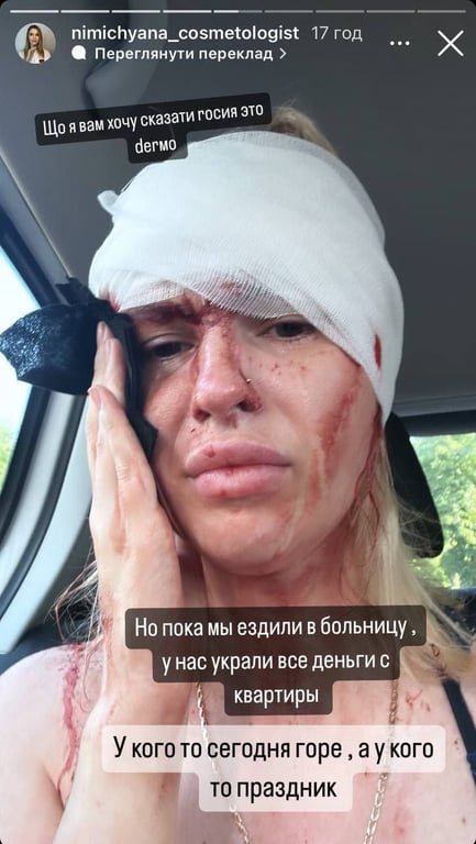 Невідомі обікрали квартиру постраждалої від обстрілу РФ у Кривому Розі