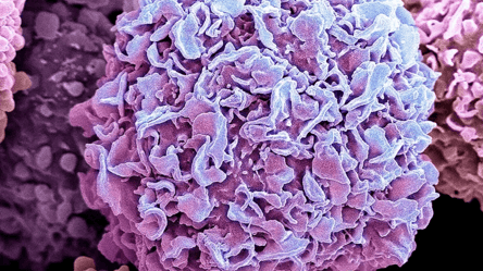 Вчені винайшли батарейку, яка знищує ракові клітини: подробиці наукового прориву - 285x160