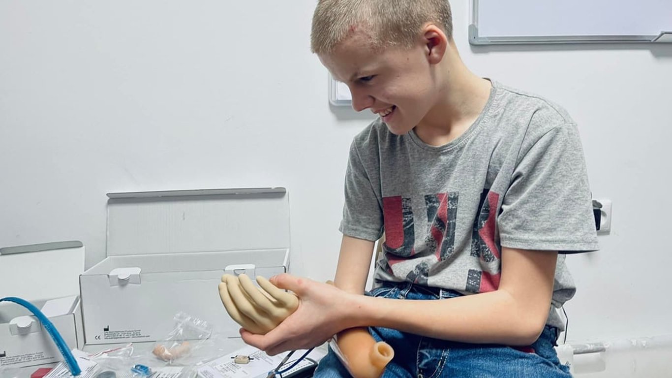 Сину українського військового виготовлять протез для руки, яку він втратив допомагаючи по господарству