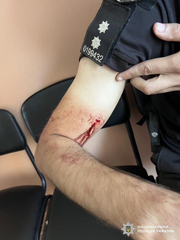 На Кіровоградщині чоловік стріляв у поліцейських