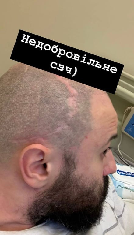 Віктор Розовий після поранення