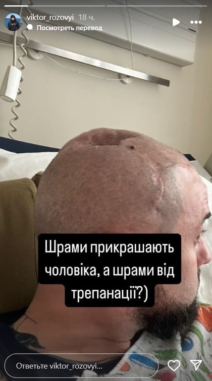 Розовий показав поранення