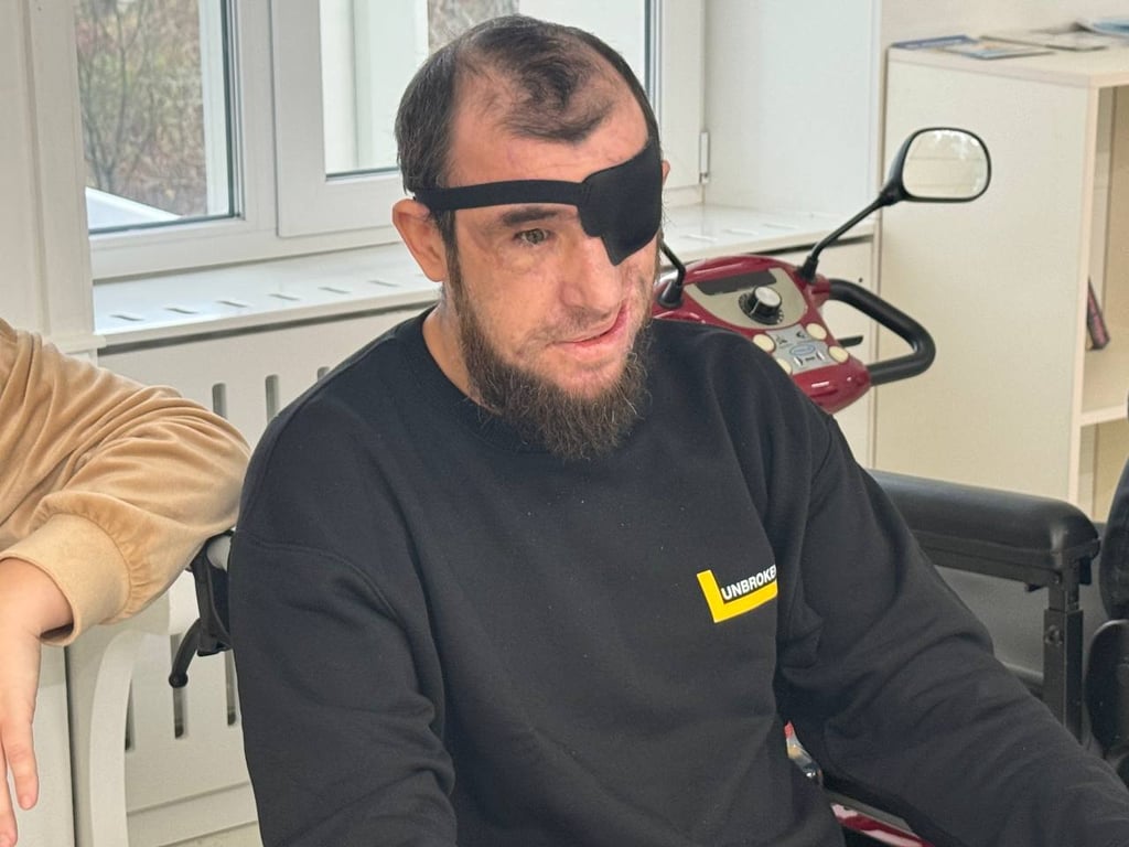 Війна забрала очі — історія захисника, який знову вчиться ходити - фото 1