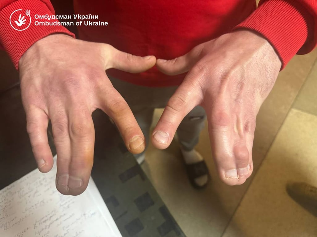 В Ужгородському ТЦК виявили порушення закону та антисанітарію