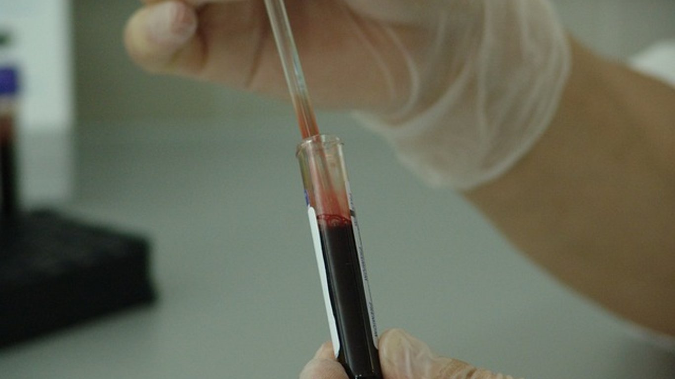 В Одессе проводят тестирование на ВИЧ