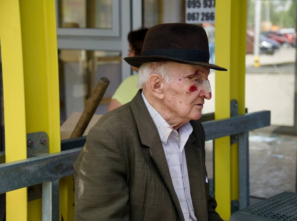 Поранений чоловік внаслідок атаки РФ на Дніпро 3 липня